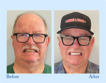 Fluoride-Free Hydroxyapatite Toothpaste - Veluzor