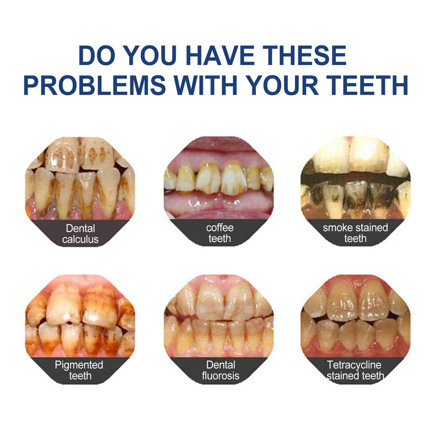 Fluoride-Free Hydroxyapatite Toothpaste - Veluzor